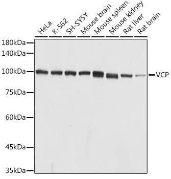 VCP Rabbit pAb