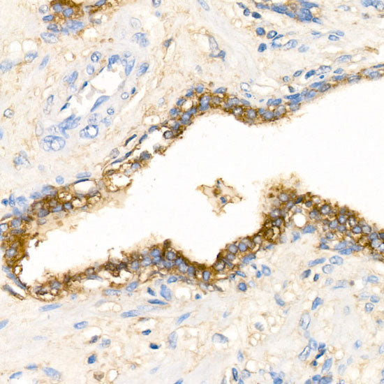 Alpha-1 Antichymotrypsin (SERPINA3) Rabbit pAb