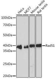 Rad51 Rabbit mAb