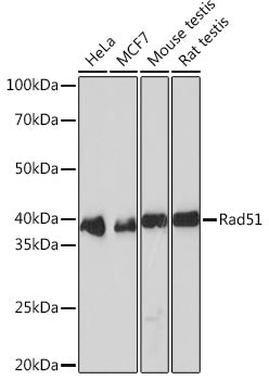 Rad51 Rabbit mAb