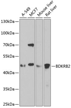 BDKRB2 Rabbit pAb