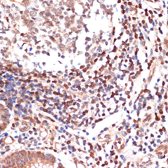 ALOX5 Rabbit mAb