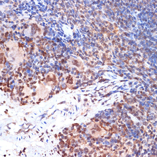 ALOX5 Rabbit mAb