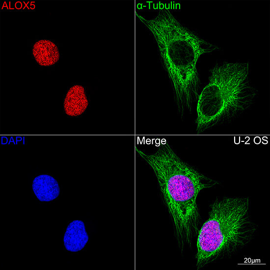 ALOX5 Rabbit mAb