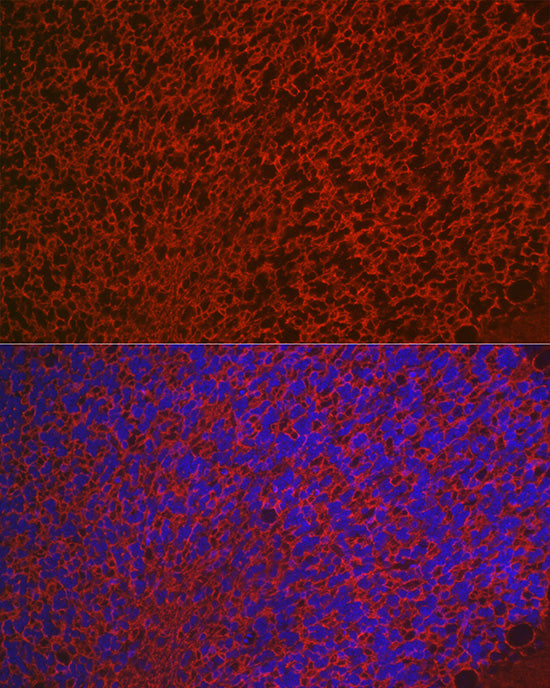 Aquaporin-4 (AQP4) Rabbit pAb