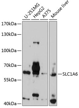 SLC1A6 Rabbit pAb