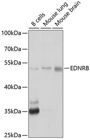 EDNRB Rabbit pAb