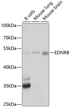 EDNRB Rabbit pAb