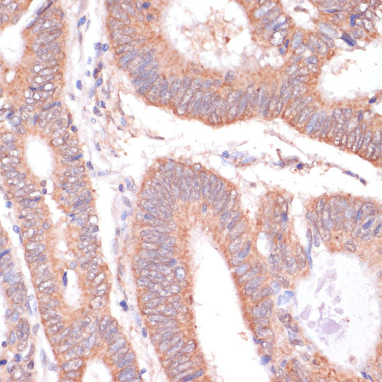 KCNH2 Rabbit pAb