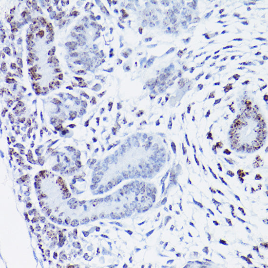 HMGA2 Rabbit pAb