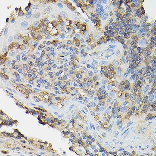 CD25 Rabbit pAb