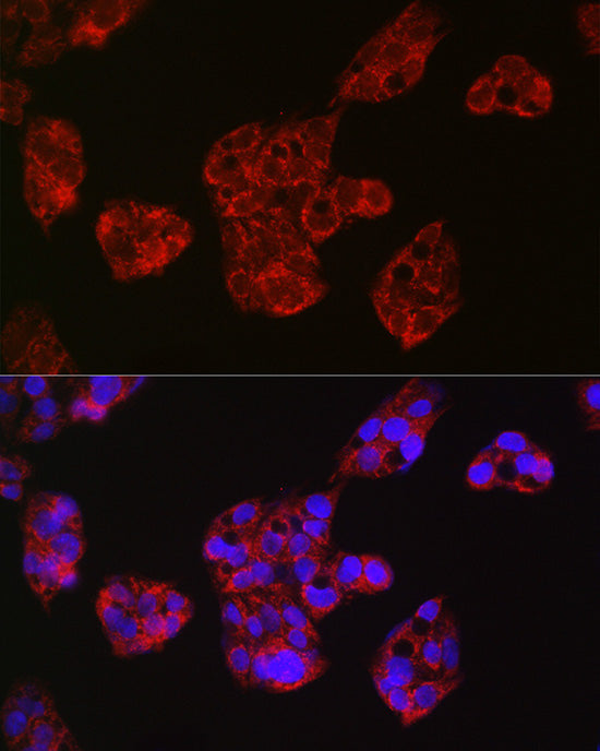 Leptin Receptor Rabbit pAb