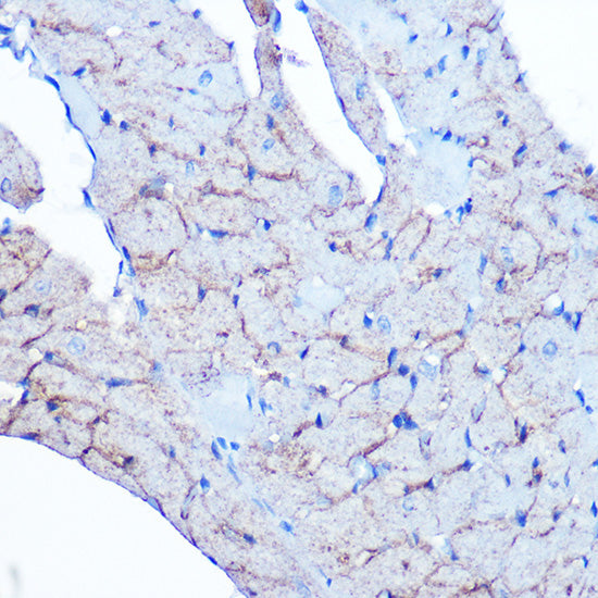 Flotillin 1 Rabbit mAb