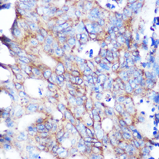 Flotillin 1 Rabbit mAb