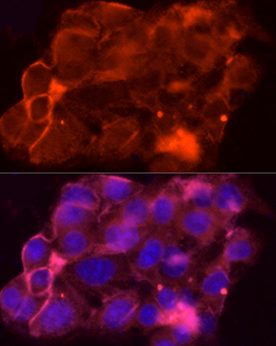 MRP1/ABCC1 Rabbit pAb