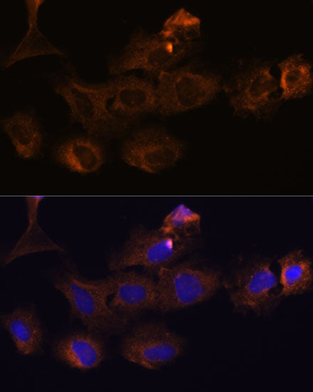 MMP25 Rabbit pAb
