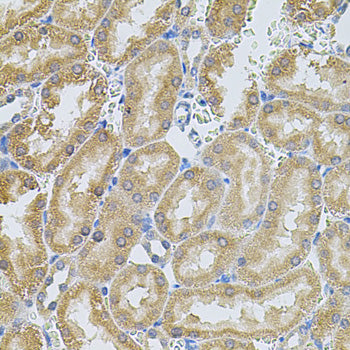 MMP10 Rabbit pAb
