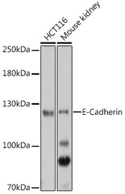 E-Cadherin Rabbit pAb