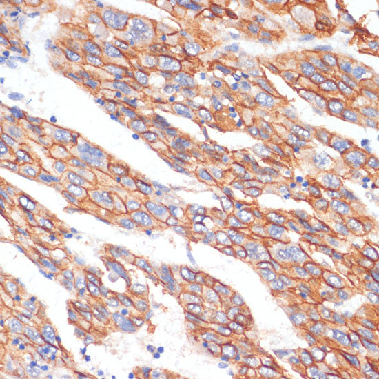 E-Cadherin Rabbit pAb