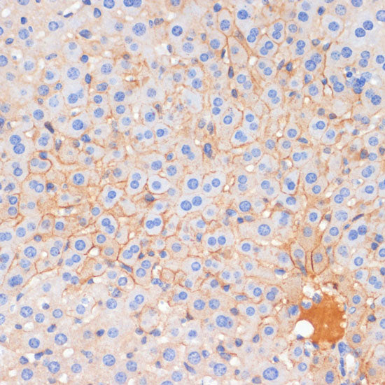 E-Cadherin Rabbit pAb