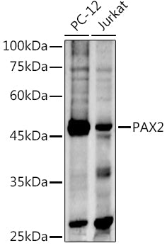 PAX2 Rabbit pAb