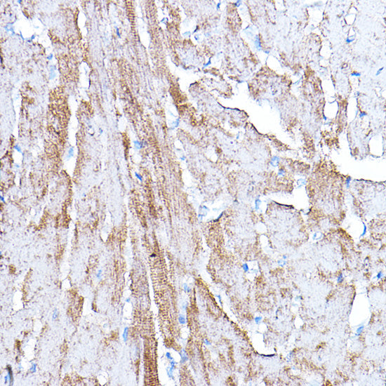 PDK4 Rabbit pAb