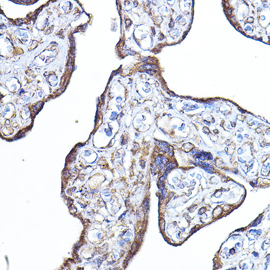 PDK4 Rabbit pAb