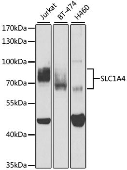 SLC1A4 Rabbit pAb