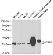 TPM2 Rabbit pAb
