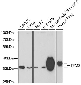 TPM2 Rabbit pAb