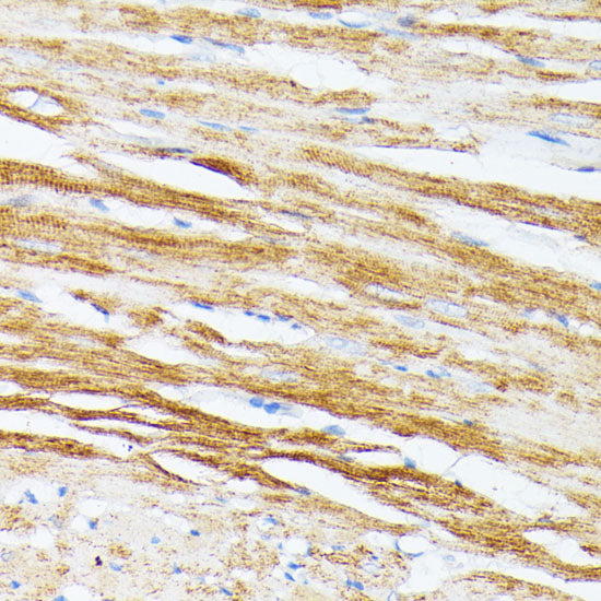 TPM2 Rabbit pAb