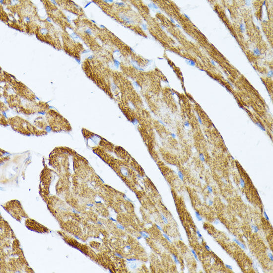 TPM2 Rabbit pAb