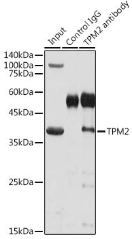 TPM2 Rabbit pAb