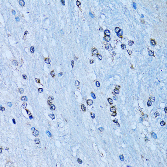 NF-κB2 Rabbit pAb