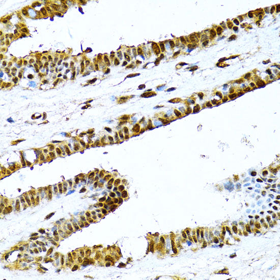 NF-κB2 Rabbit pAb