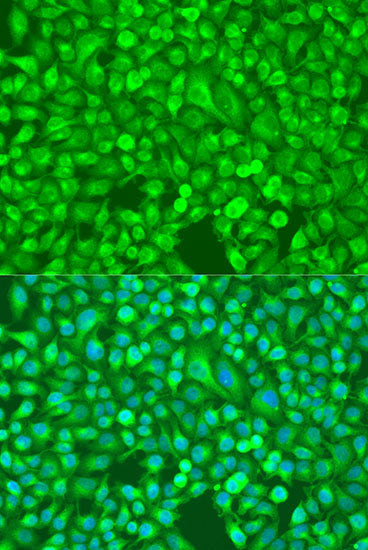 NF-κB2 Rabbit pAb