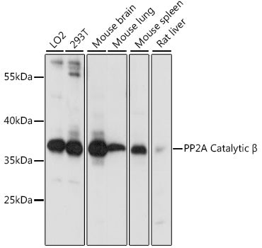 PP2A Catalytic β Rabbit pAb