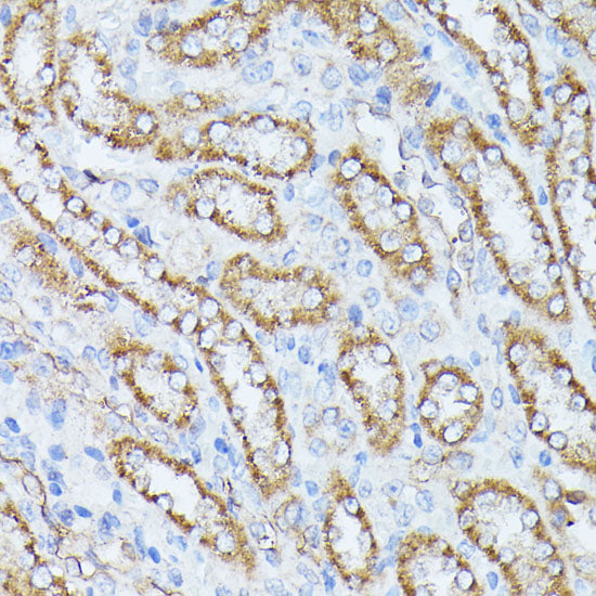 PP2A Catalytic β Rabbit pAb