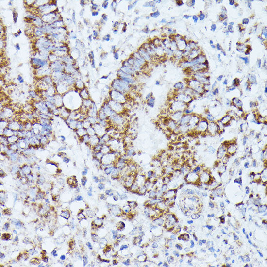 PP2A Catalytic β Rabbit pAb
