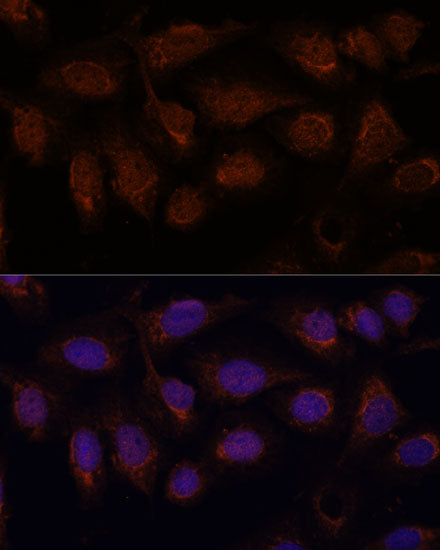 PP2A Catalytic β Rabbit pAb