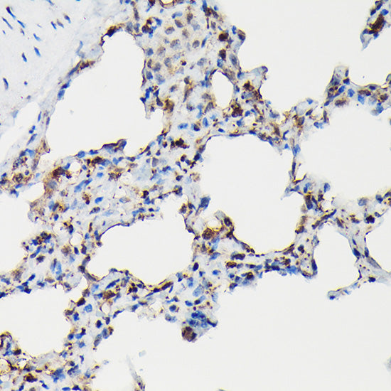 SFTPA1 Rabbit pAb