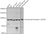 Somatostatin Receptor 2 (SSTR2) Rabbit pAb