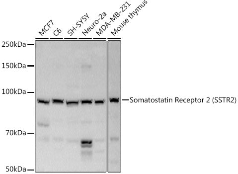 Somatostatin Receptor 2 (SSTR2) Rabbit pAb