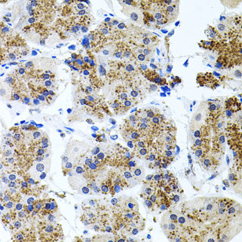 Somatostatin Receptor 2 (SSTR2) Rabbit pAb