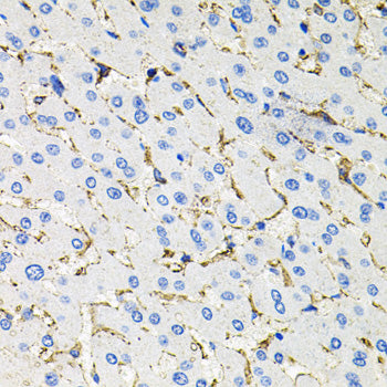 Somatostatin Receptor 2 (SSTR2) Rabbit pAb