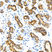 E-Cadherin mouse mAb