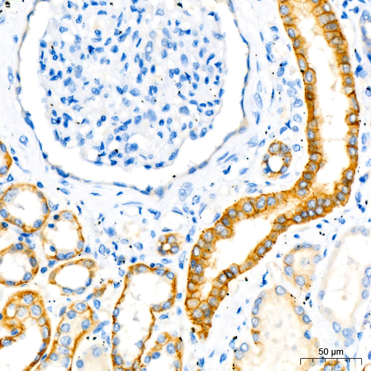 E-Cadherin mouse mAb
