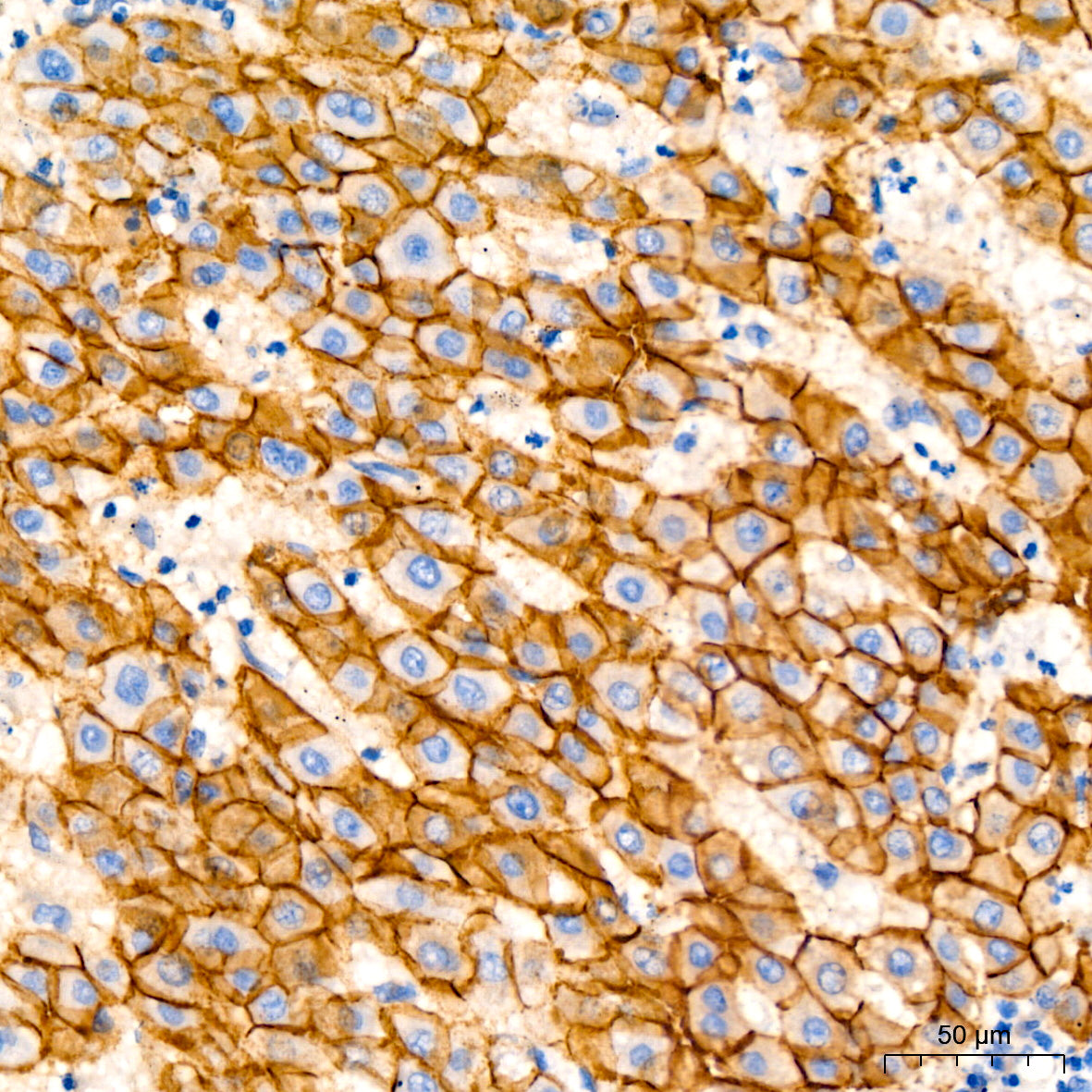 E-Cadherin mouse mAb