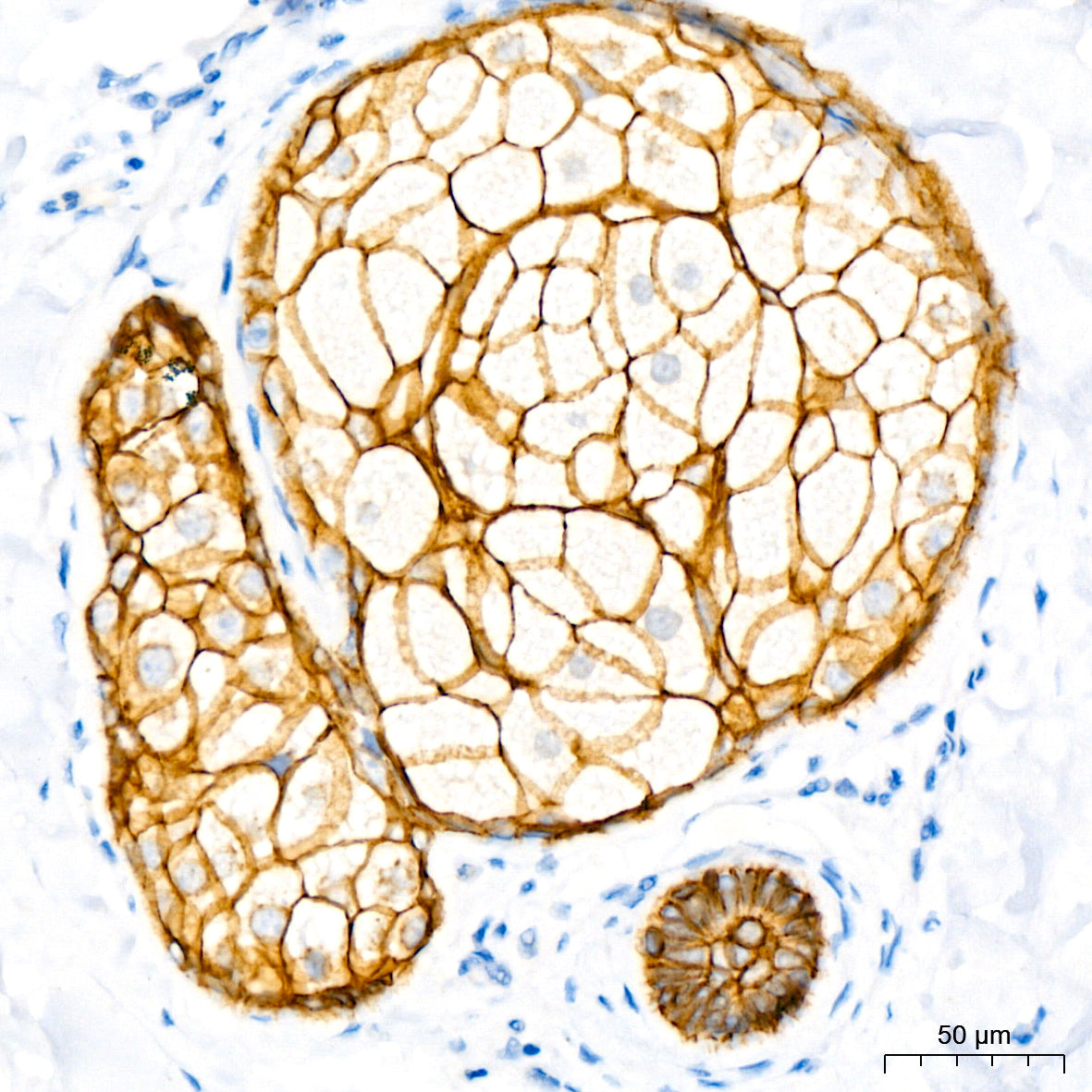 E-Cadherin mouse mAb