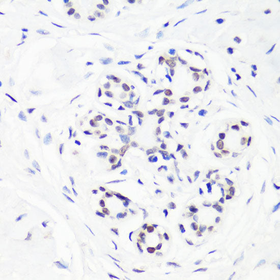 MonoMethyl-Histone H3-R17 Rabbit pAb